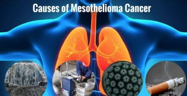Causes-Mesothelioma
